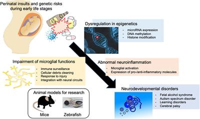 Epigenetics and Neuroinflammation Associated With Neurodevelopmental Disorders: A Microglial Perspective